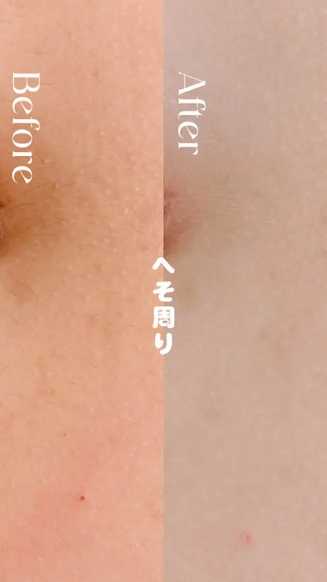Hitomi シュガーリング豊橋のその他イメージ