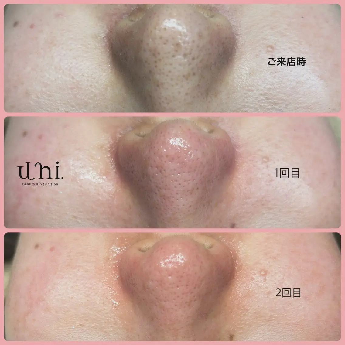 uni. beautyのエステ・リラクイメージ