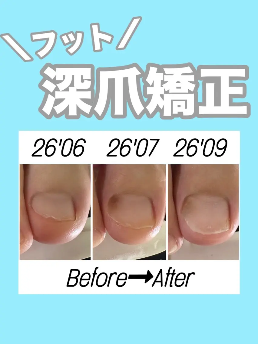 ネイル クリアネイル フットネイル ジェルネイル フットネイル nail salon petillantのネイルデザイン