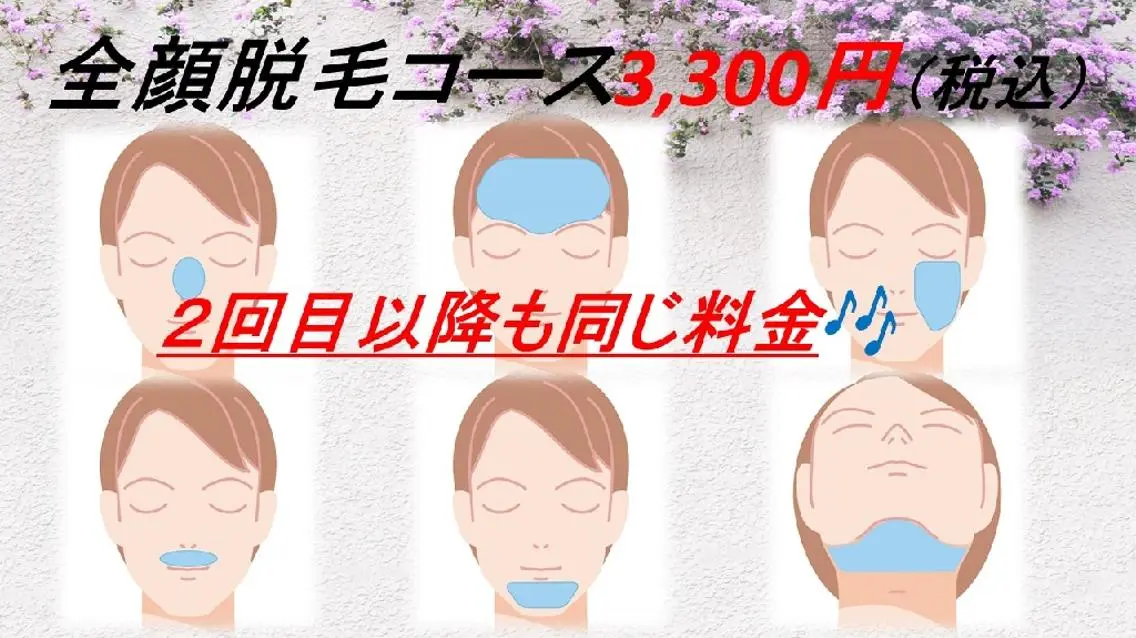 （二番人気🌟）メンズ全顔脱毛コースの写真