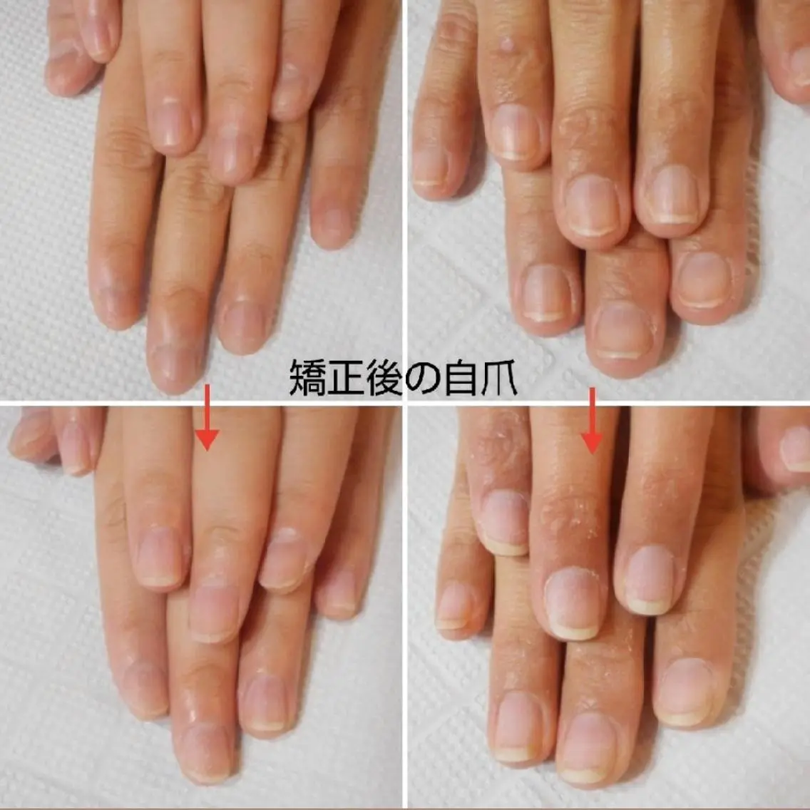 ネイル ネイルサロン アリュームのネイルデザイン