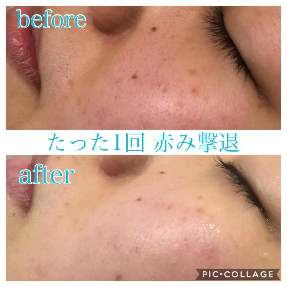 ショート カラー パーマ ヘアアレンジ キッズ ネイル マツエク・マツパ EnsorClair 代表　野口真央のエステ・リラクイメージ