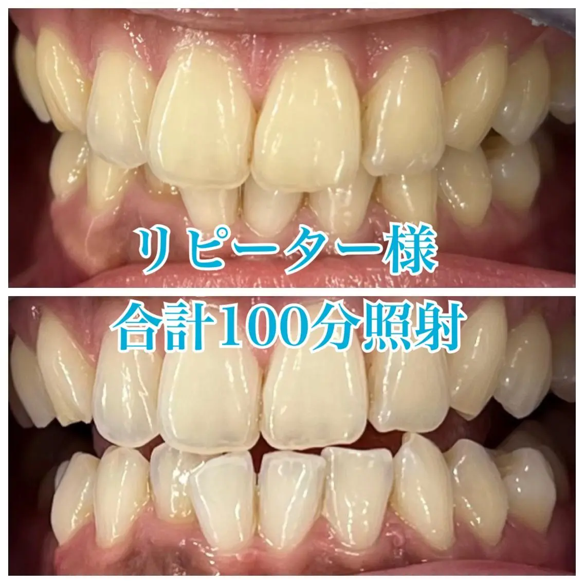 ホワイトニング🦷 ネイル💅LEAのその他イメージ