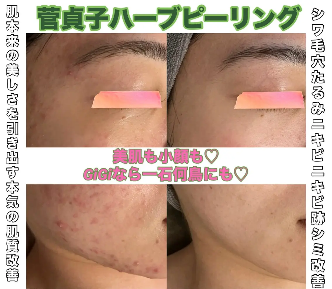 SALON DE GiGiのエステ・リラクイメージ