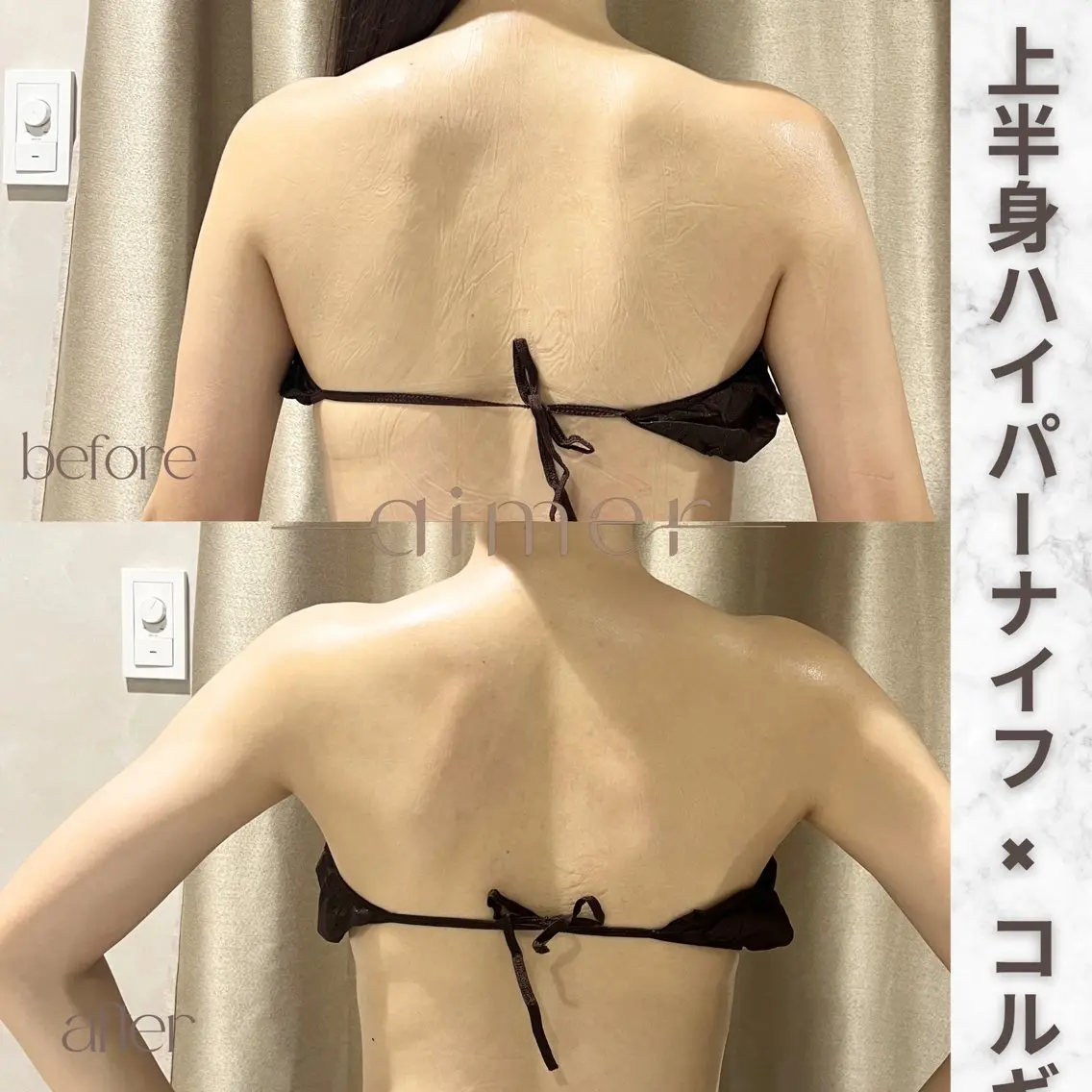 aimer服部 /  小顔 ・ 痩身のその他イメージ