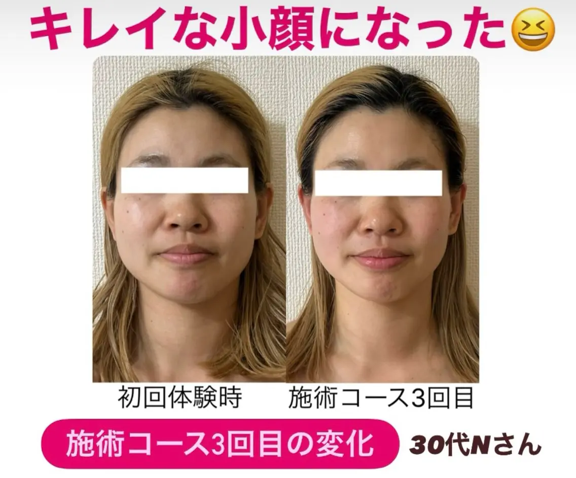 小顔サロン (ラ リュミエール)のエステ・リラクイメージ