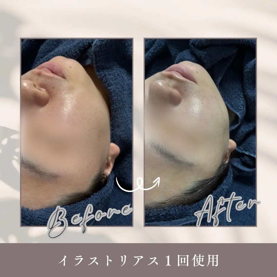 エステ Amor 渡邉のエステ・リラクイメージ