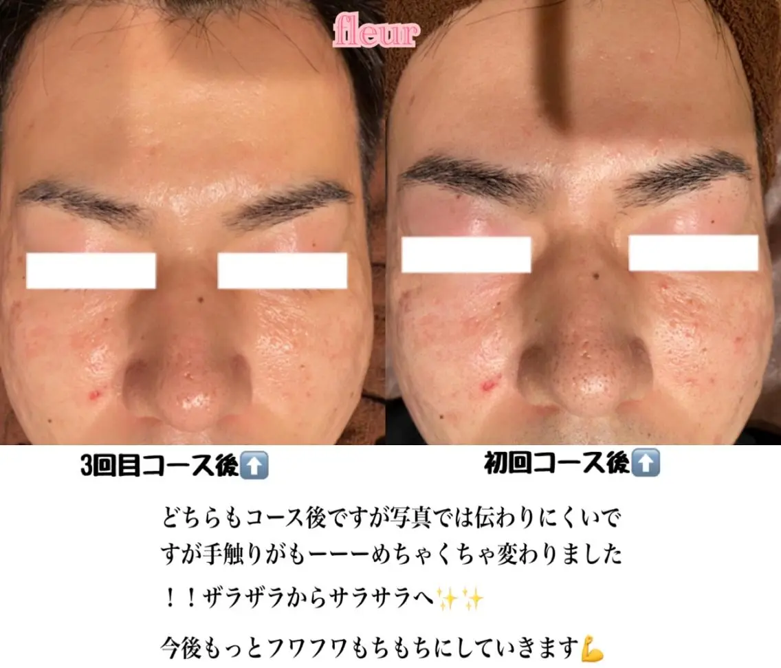 エステ Fleur フルールのエステ・リラクイメージ
