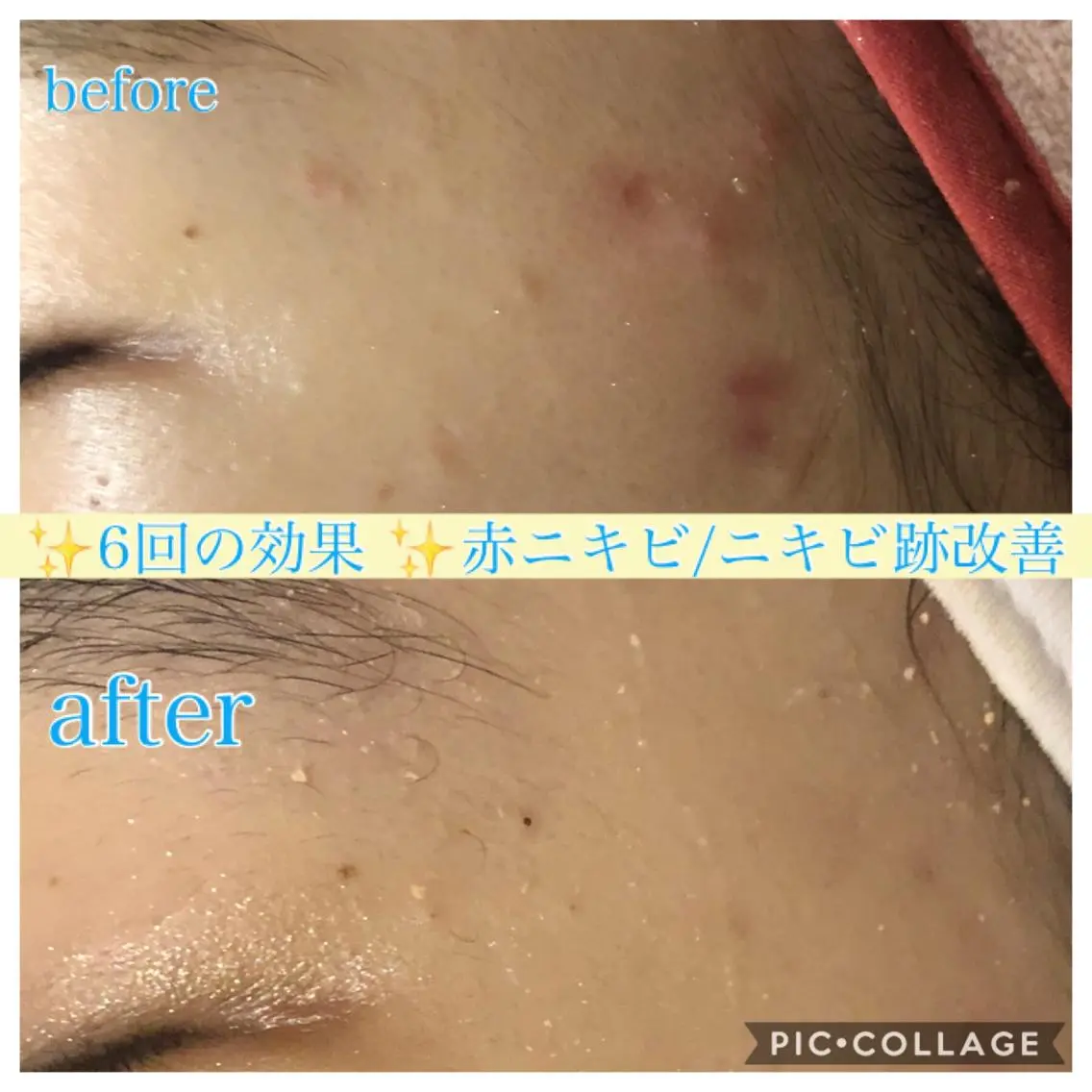 ロング カラー パーマ ヘアアレンジ メンズ キッズ ネイル マツエク・マツパ エステ リラク EnsorClair 代表 野口真央のエステ・リラクイメージ