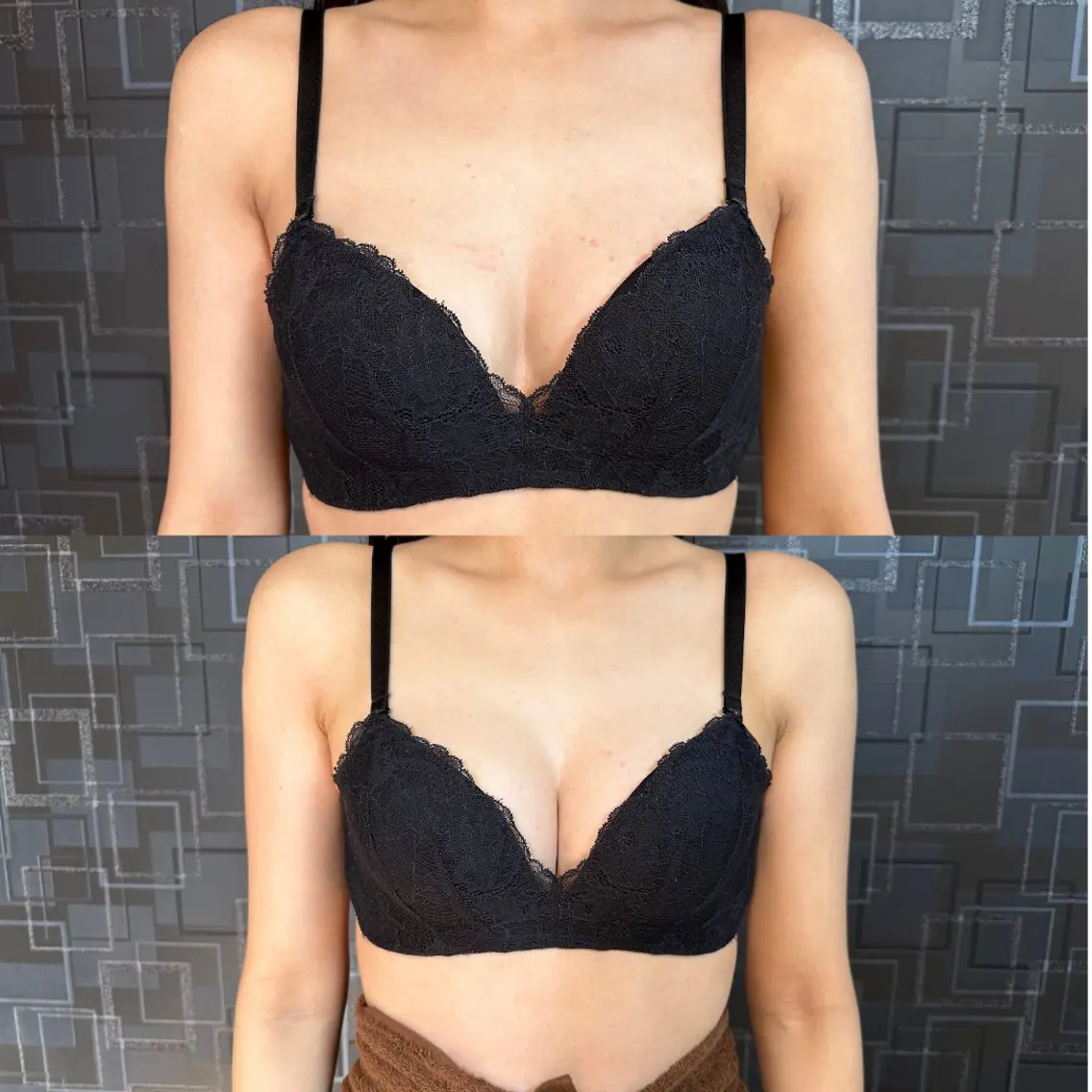 【形を綺麗にしたい】美乳を創るバストケア施術の写真