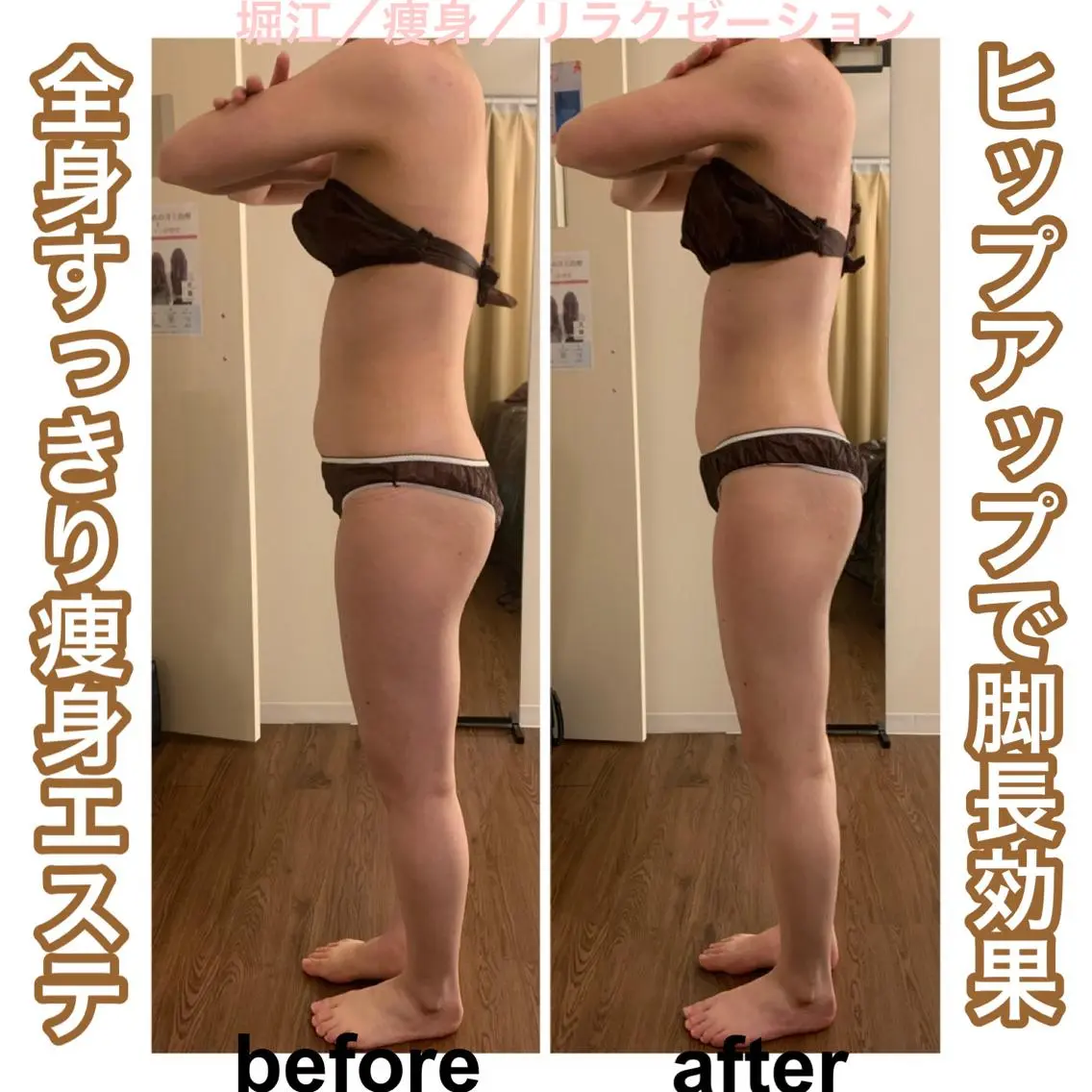 【痩せたい方はこれ】脂肪にアプローチ、排出促進★全身痩身エステ100分コース(ヘッドマッサージ付)の写真