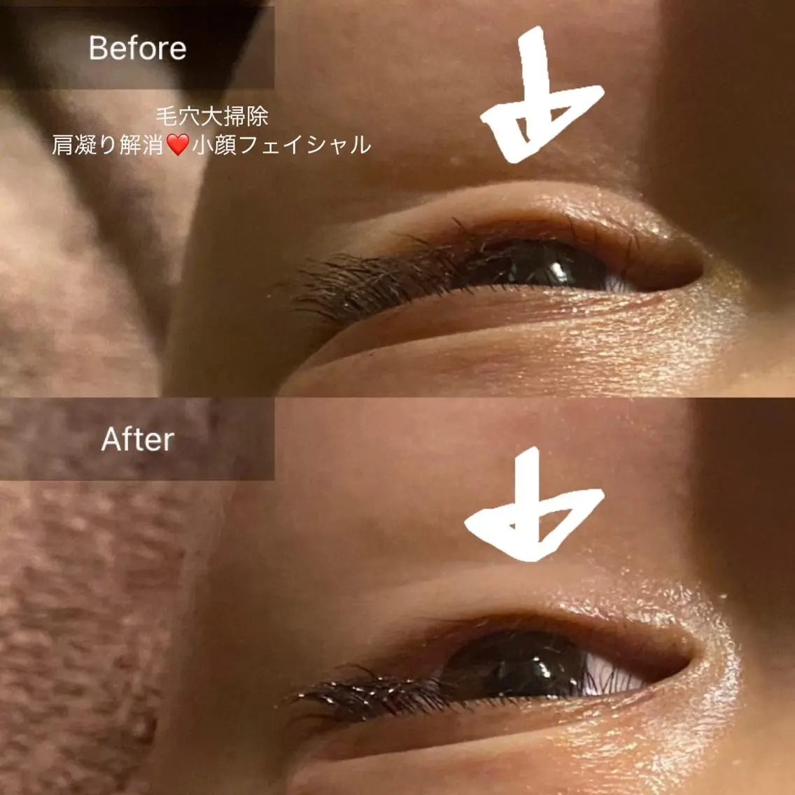 毛穴から始める肌メン テマンダリンオレンジのエステ・リラクイメージ
