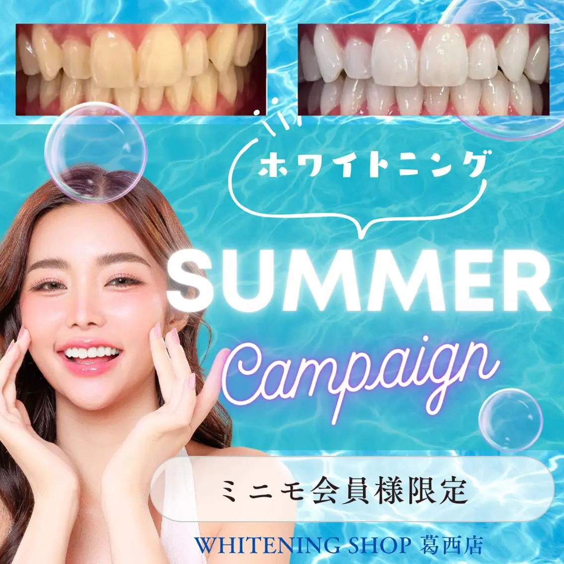 メンズ その他 ホワイトニング ショップ葛西店のその他イメージ