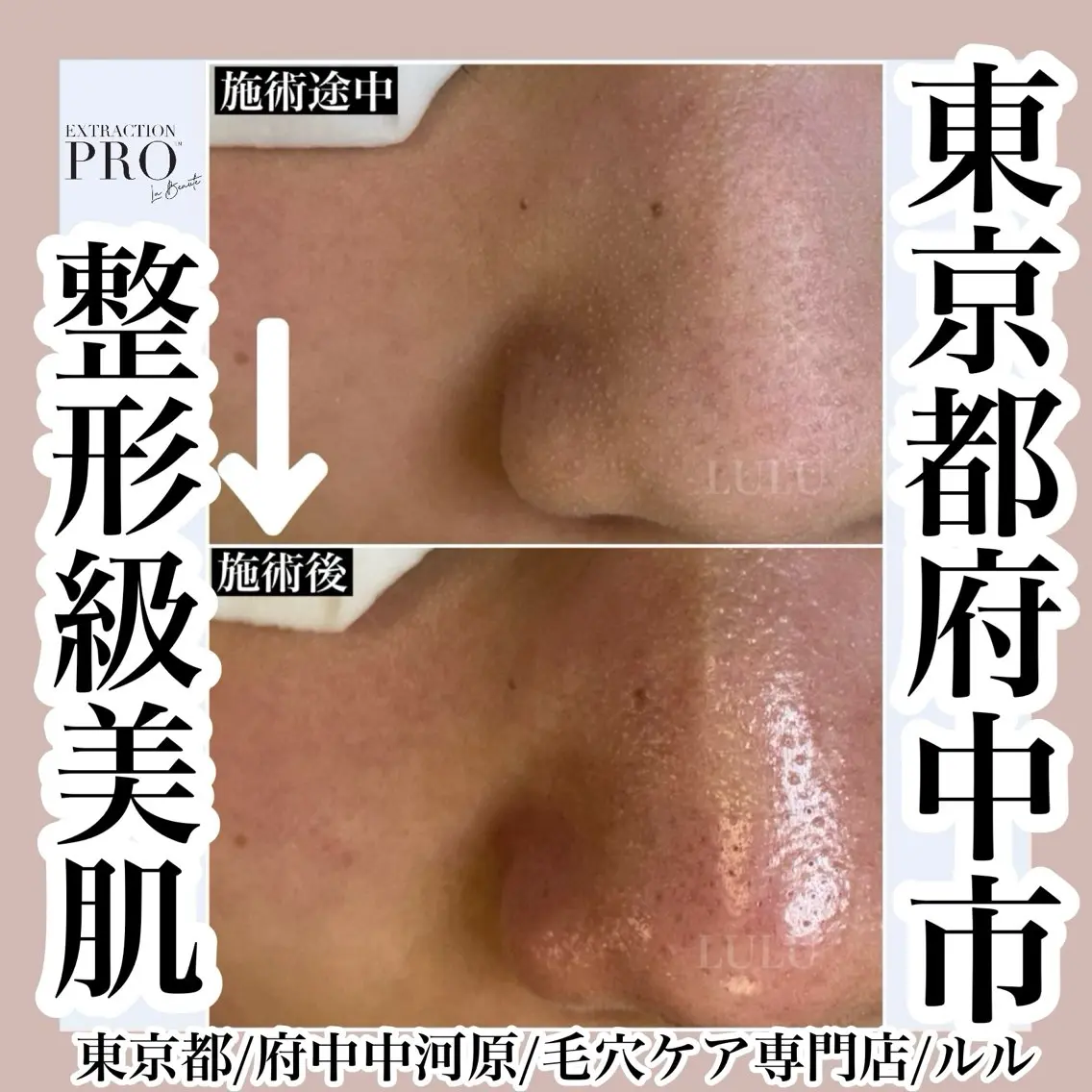 その他 LULU ルルのエステ・リラクイメージ