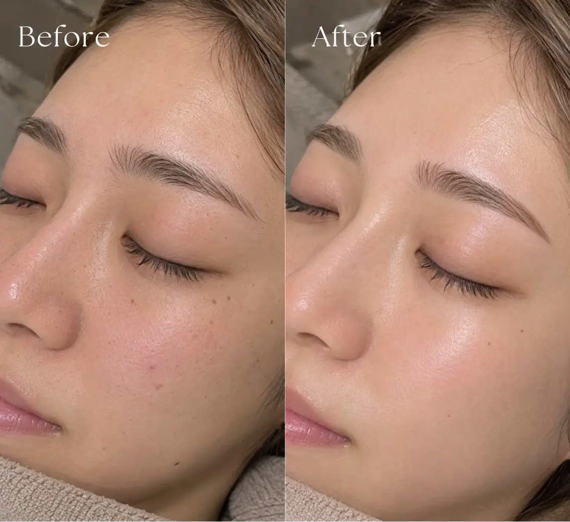 【HBL+フェイシャルWAX】セットクーポンの写真