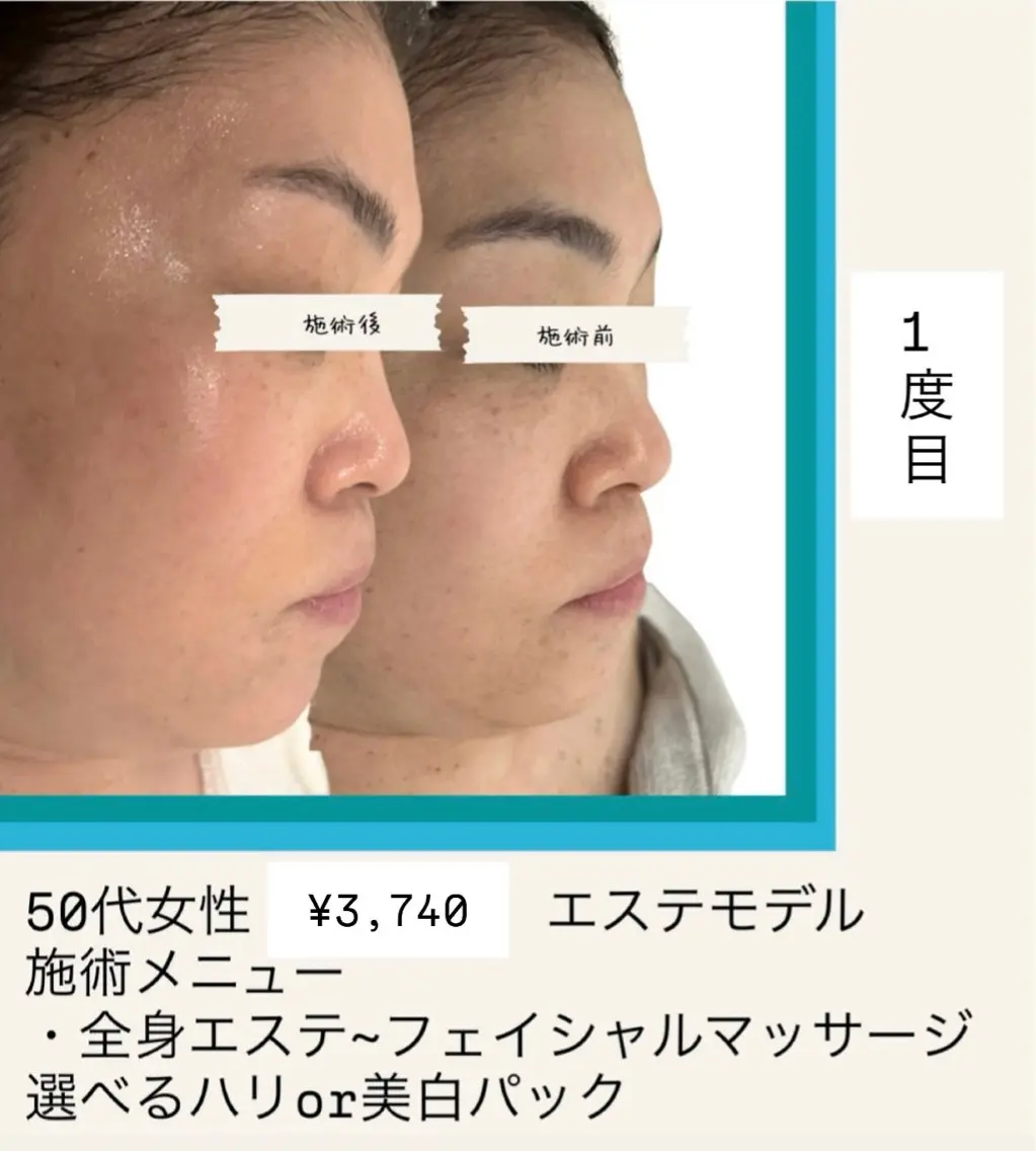 エステ 丸￤POLA南船場 エステ￤肌質改善のエステ・リラクイメージ