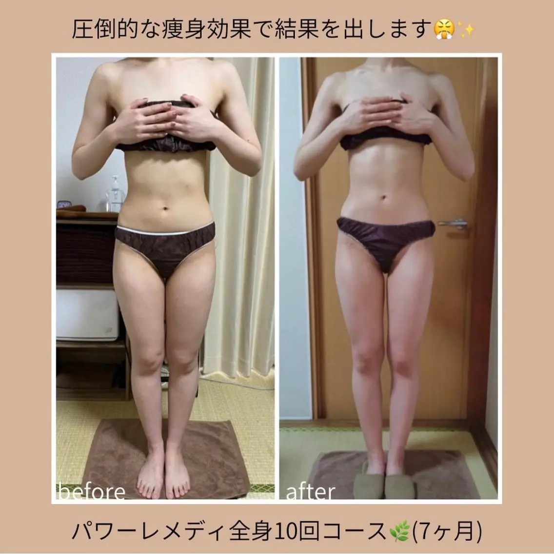 《本気痩せ×疲労改善 》 BILOOPのエステ・リラクイメージ