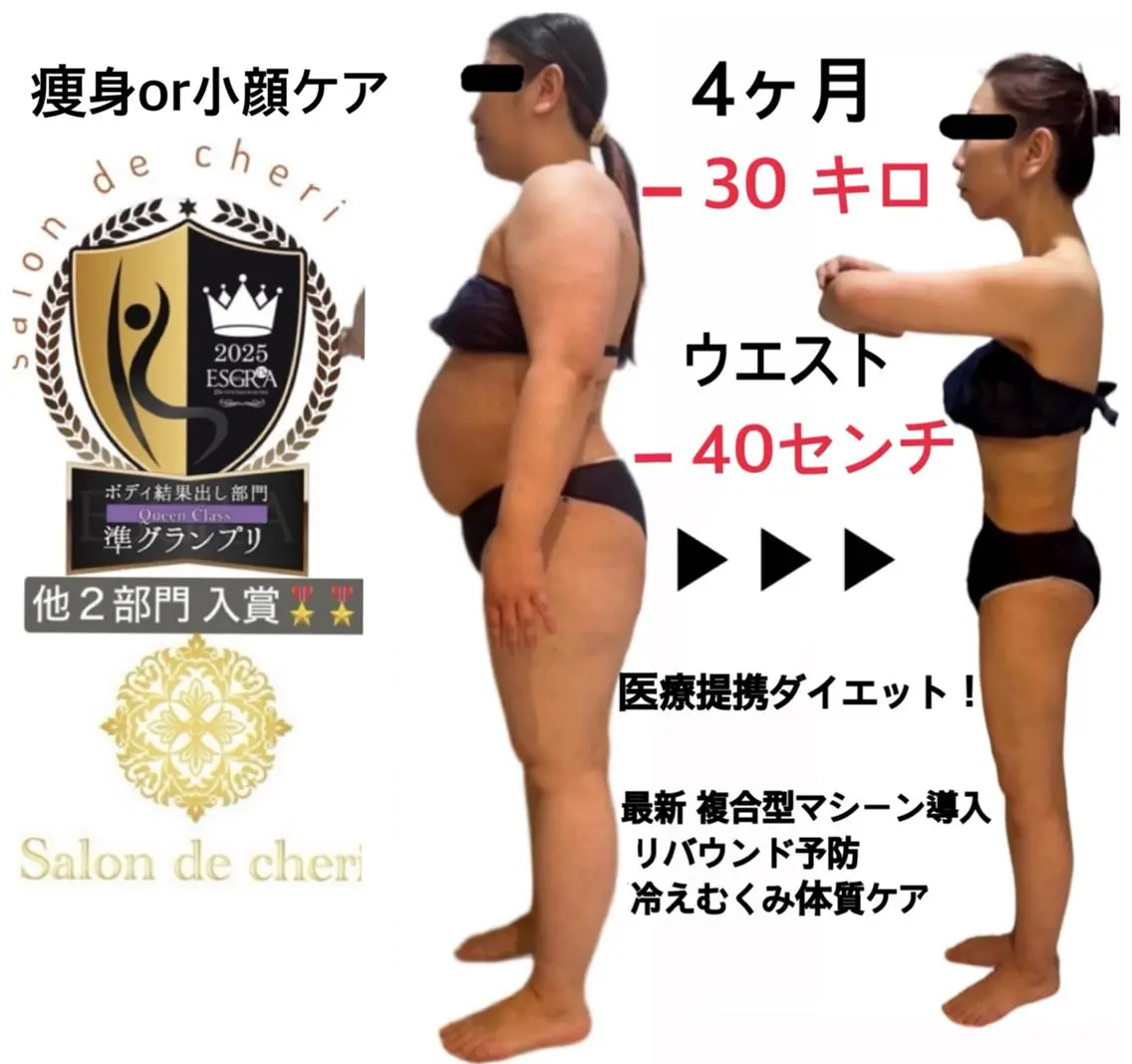 【モニター価格】小顔or痩身ボディ🔥¥1980🔥82%OFF🔥本気痩せ!最新複合機痩身👙の写真