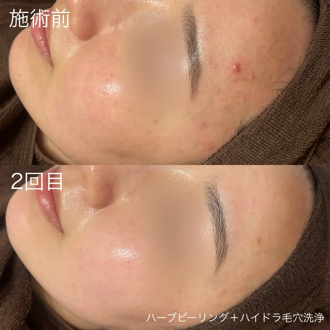 脱毛 lulularico Yuのネイルデザイン
