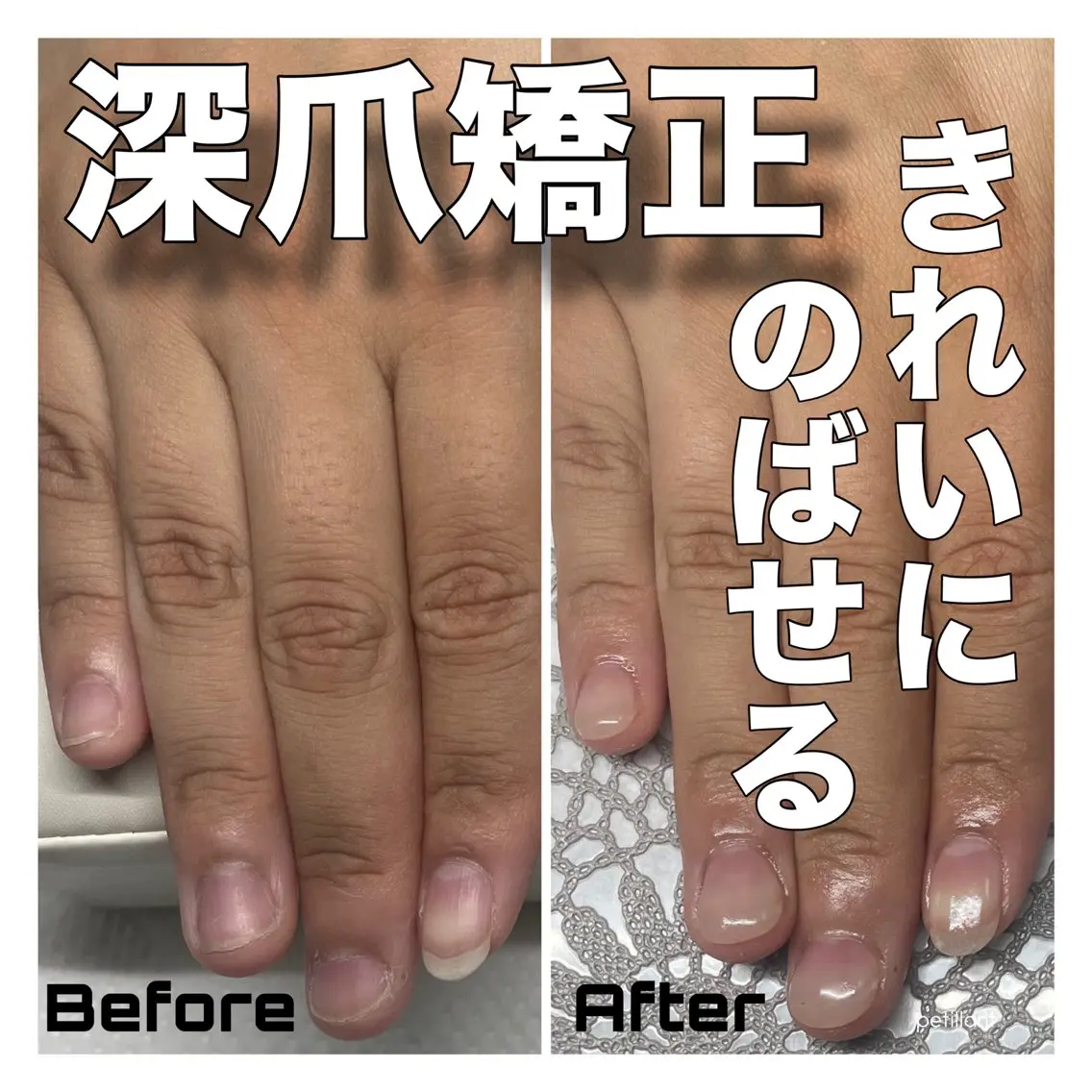 ネイル 長さ出し nail salon petillantのネイルデザイン