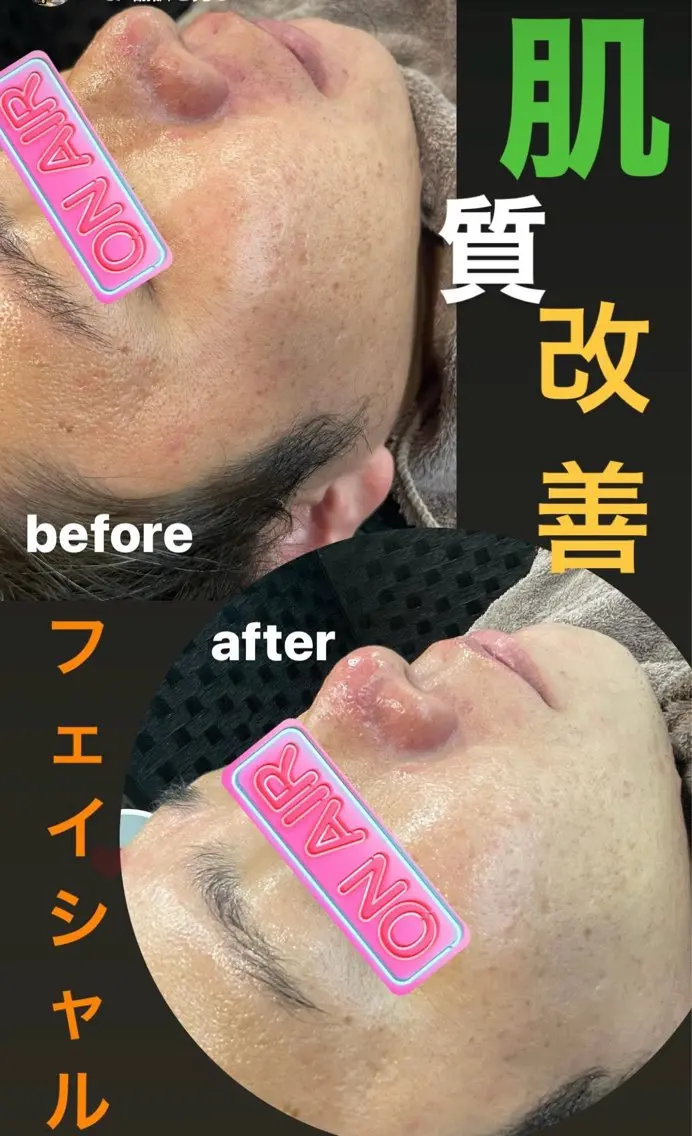 メンズ エステ リラク 大阪脱毛|ちぇるま| 眉毛Wax|美肌管理のエステ・リラクイメージ