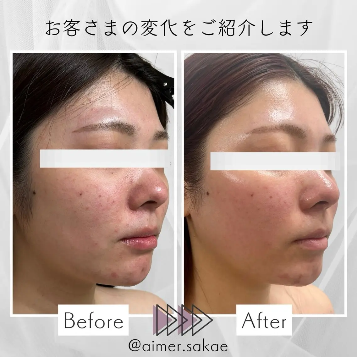 aimer 佐々木のエステ・リラクイメージ