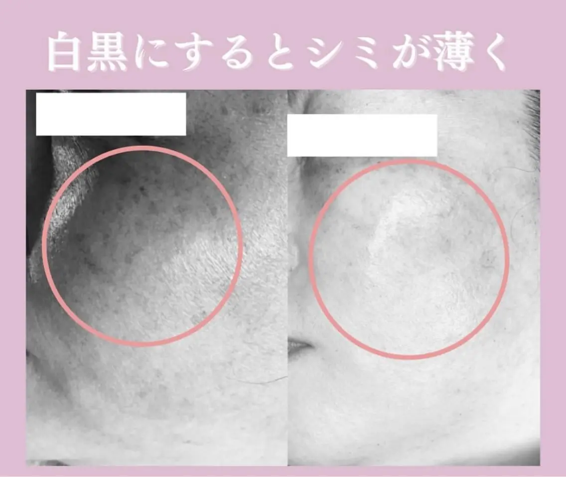 🦋肌改善 laule'a🦋のエステ・リラクイメージ