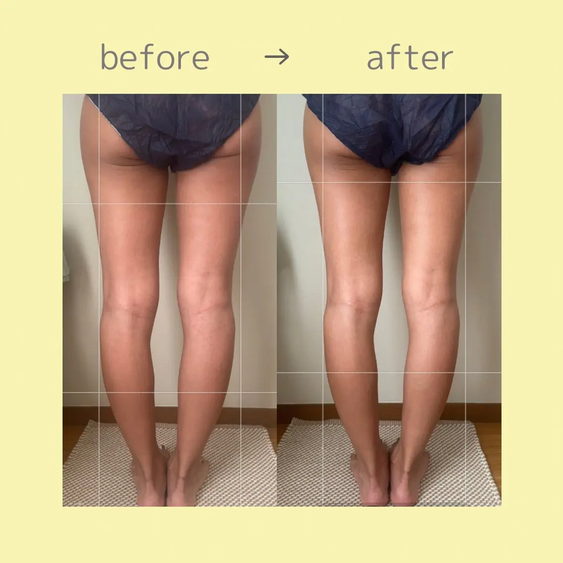 spaHINOKI 【女性専用】のエステ・リラクイメージ