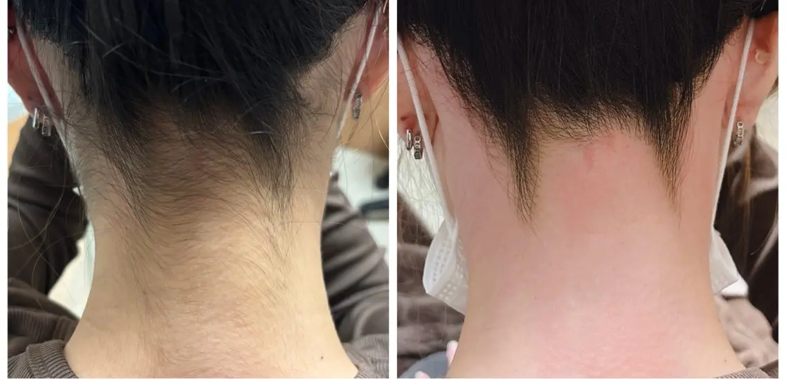 脱毛 salon lady_goのエステ・リラクイメージ