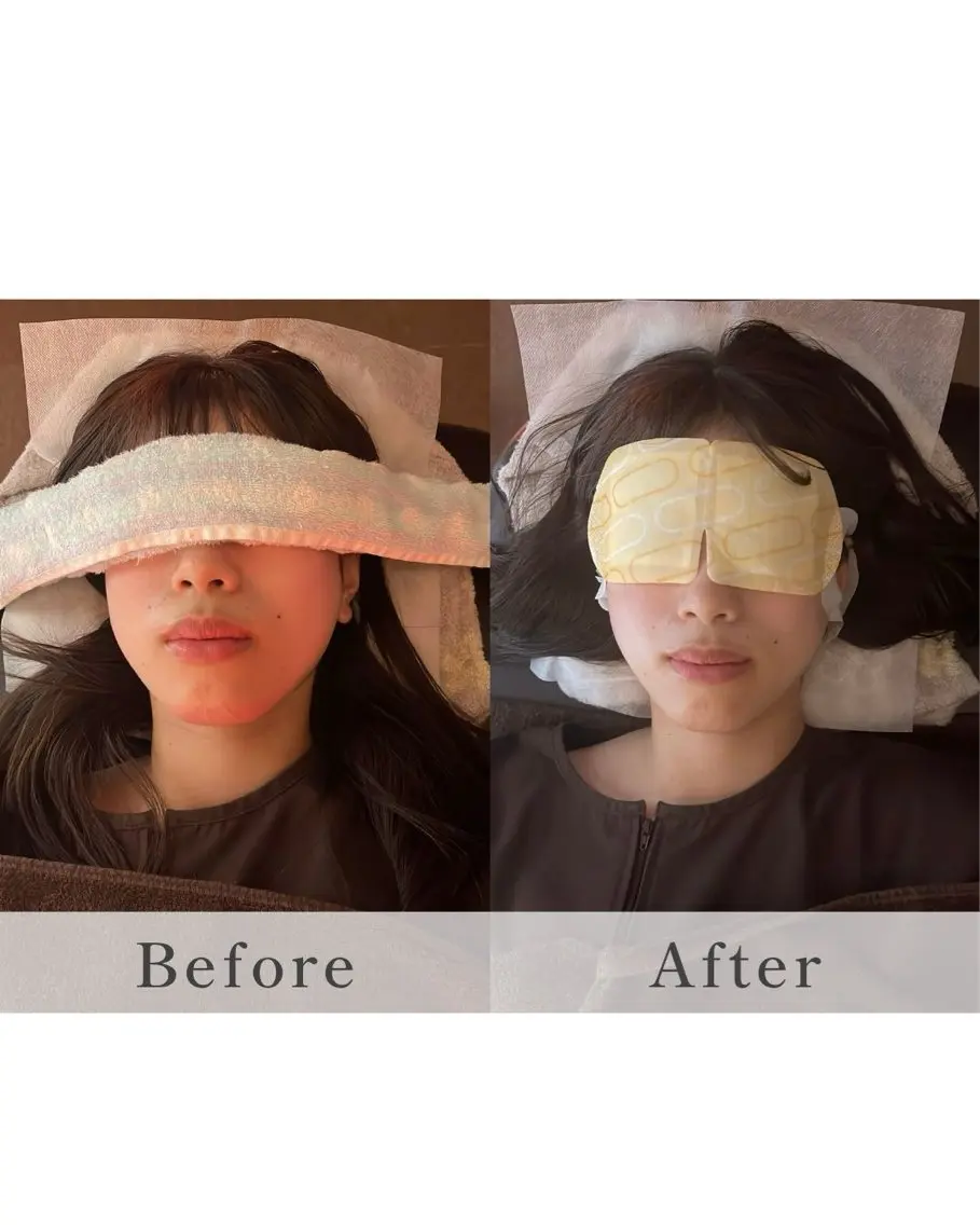 【当日お顔が小さくなる】お写真を撮られるご予定のある方は是非✨小顔矯正✖️フェイシャルオイルマッサージ✖️お顔のEMSの写真