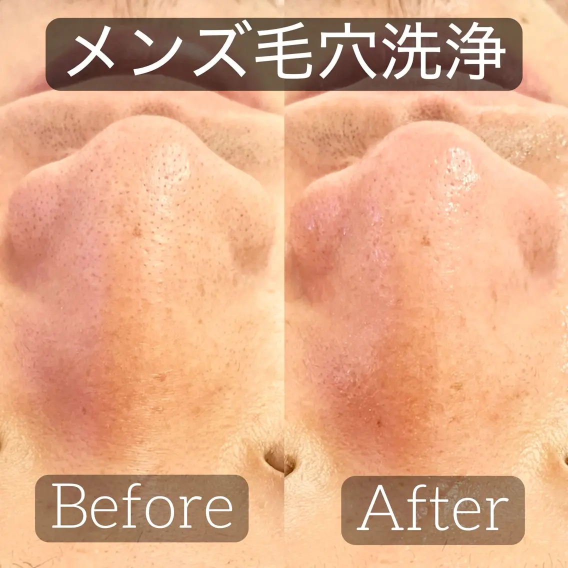 小顔&毛穴・肌質改善 LINDA西宮 AIのエステ・リラクイメージ