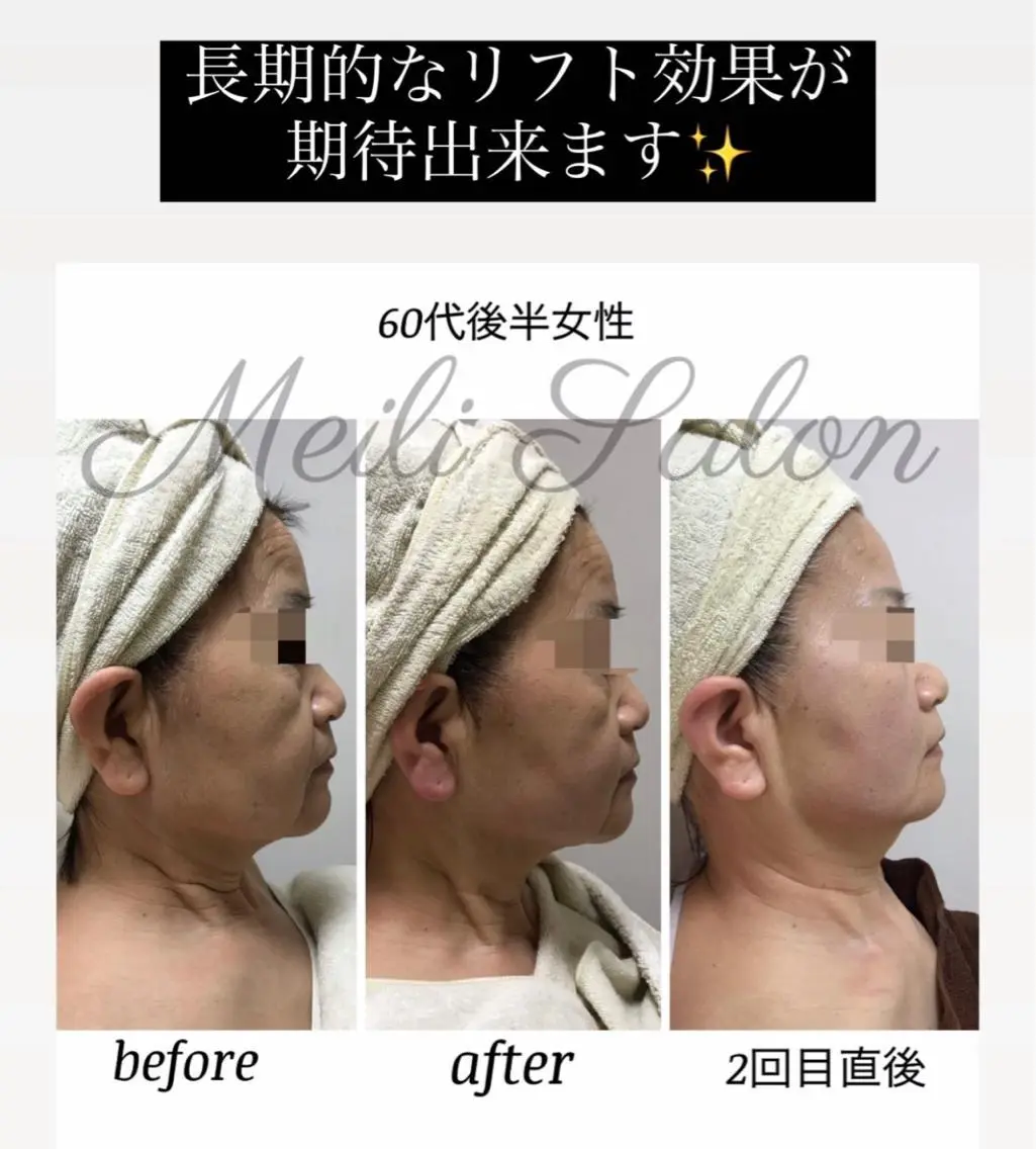 meili salonのエステ・リラクイメージ