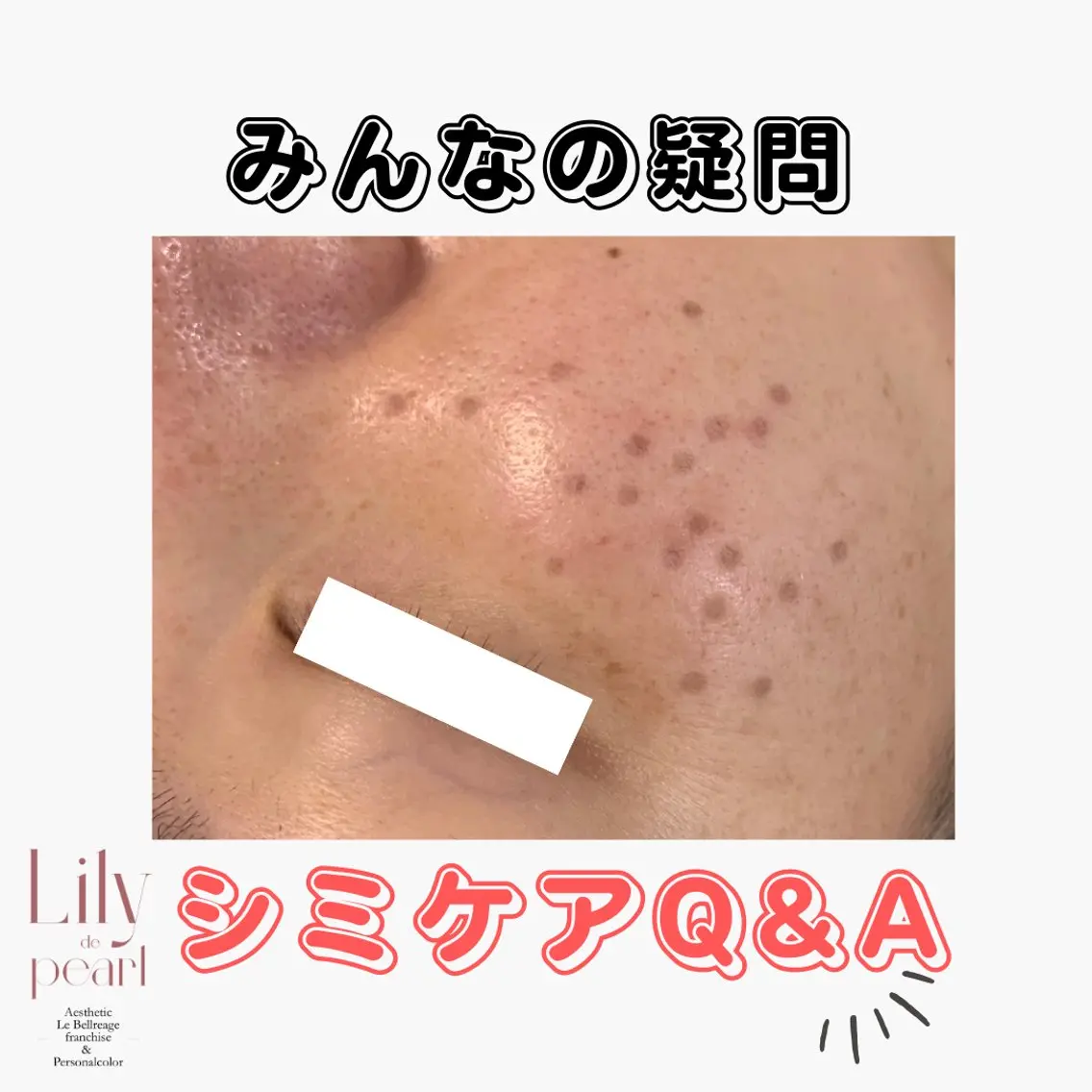 エステ 最新シミケアLily de pearlのエステ・リラクイメージ
