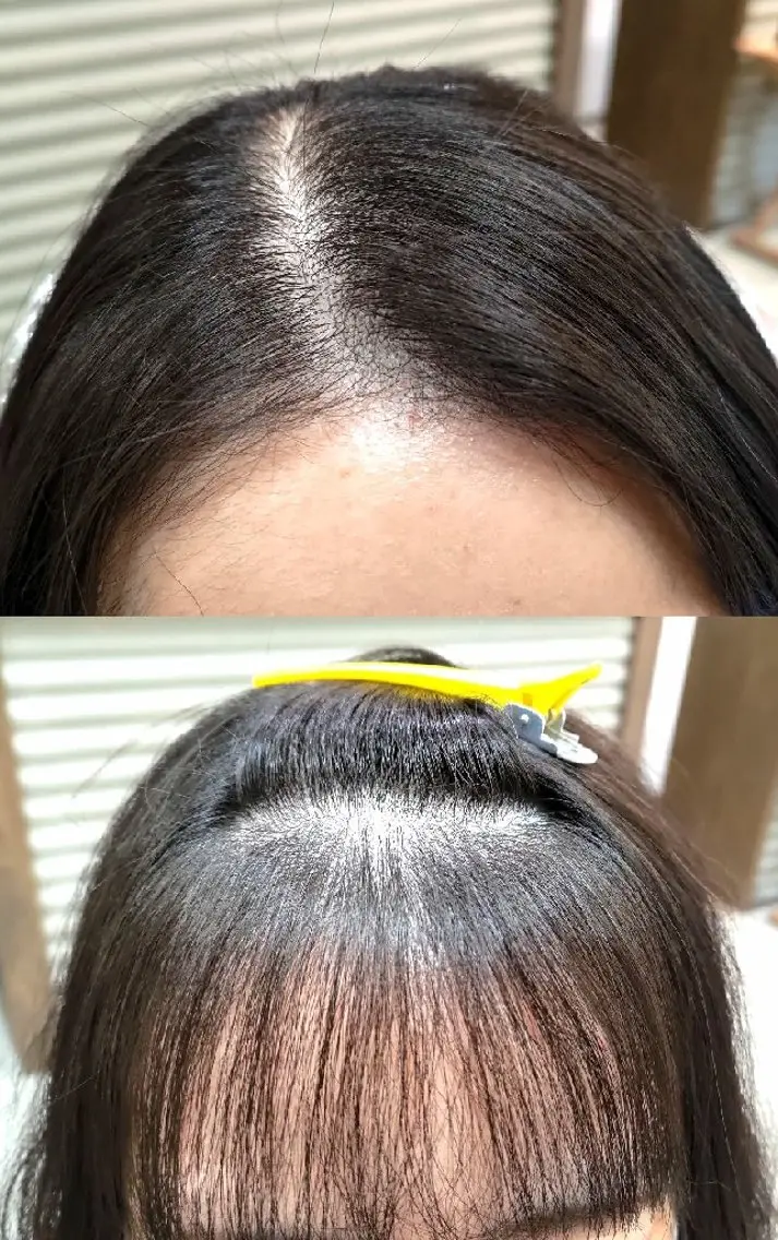 パーマ ストレートパーマ a- akiraのヘアスタイル