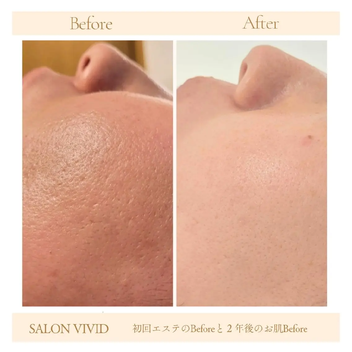 salon vividのエステ・リラクイメージ