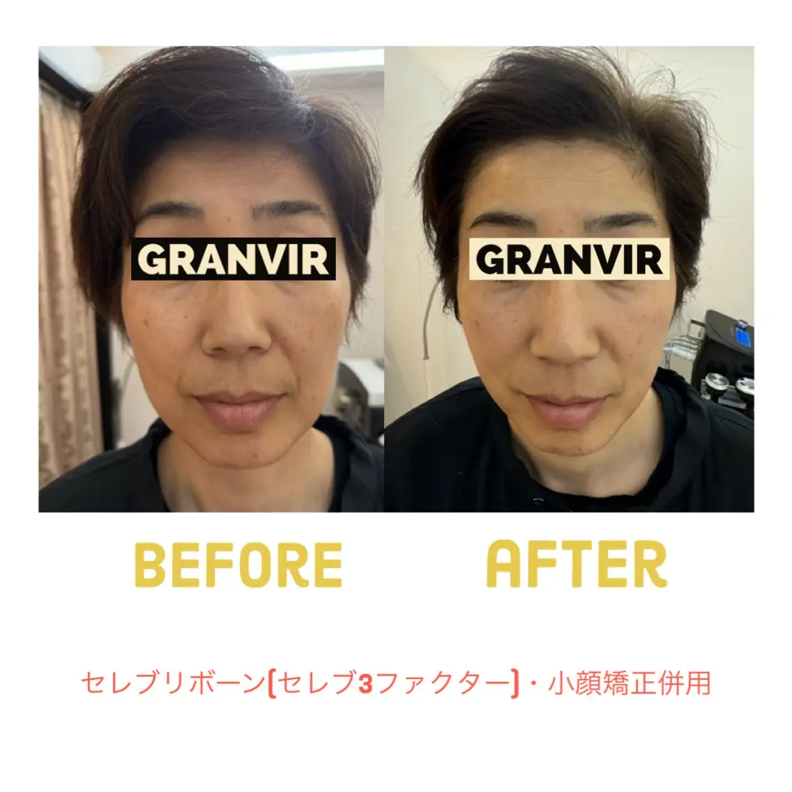 GRANVIR グランヴィールのエステ・リラクイメージ