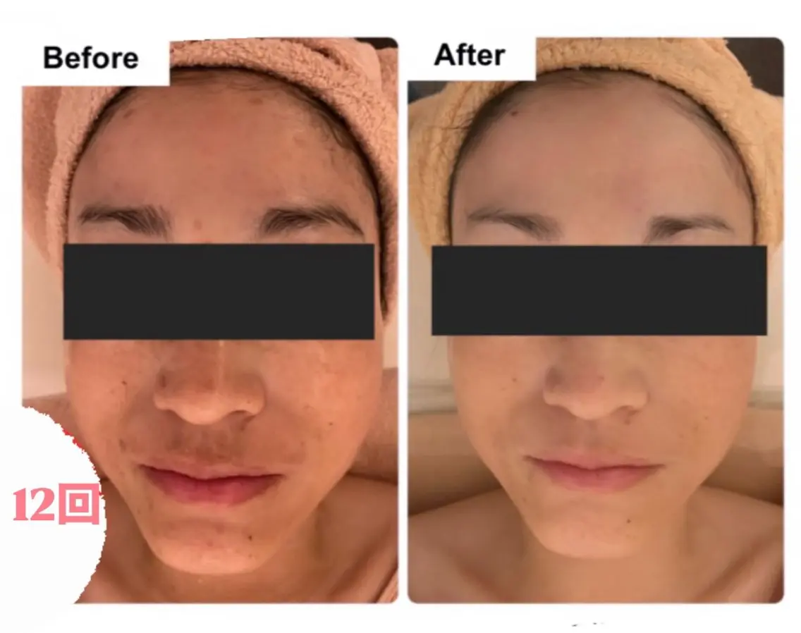 エステ esthesalon O'-en-のエステ・リラクイメージ