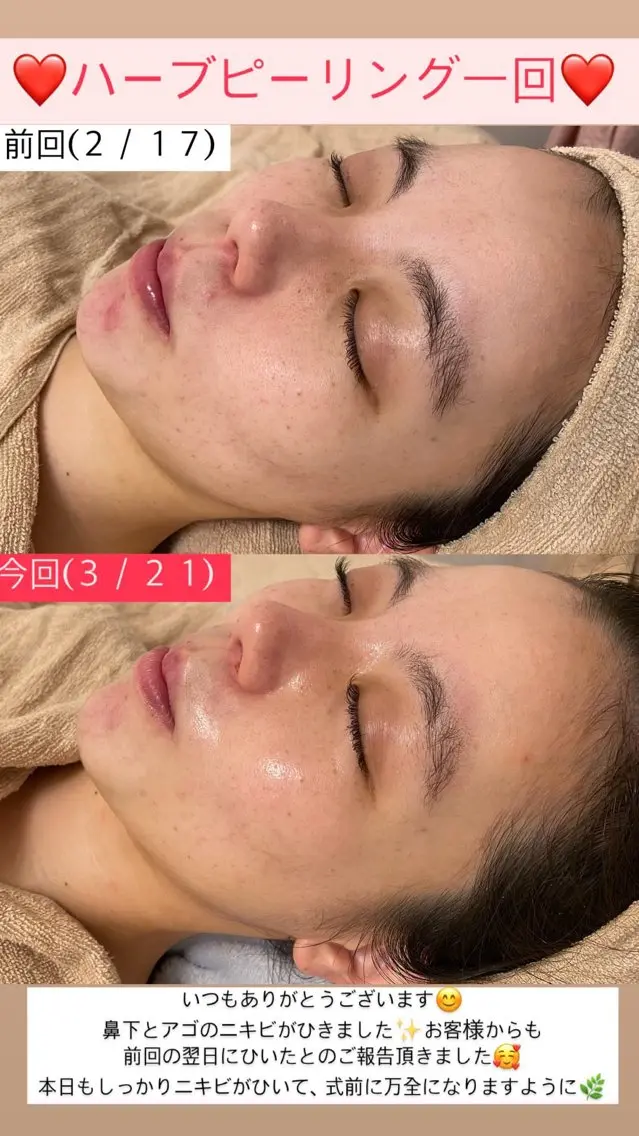 エステ Salon de Lino 御器所のエステ・リラクイメージ
