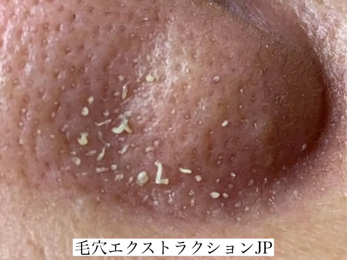エステ 佐々木 風奈のエステ・リラクイメージ