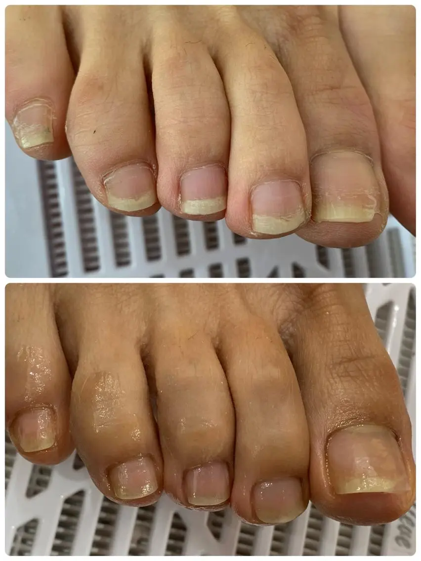 通常フットケア（メンズOK）の写真