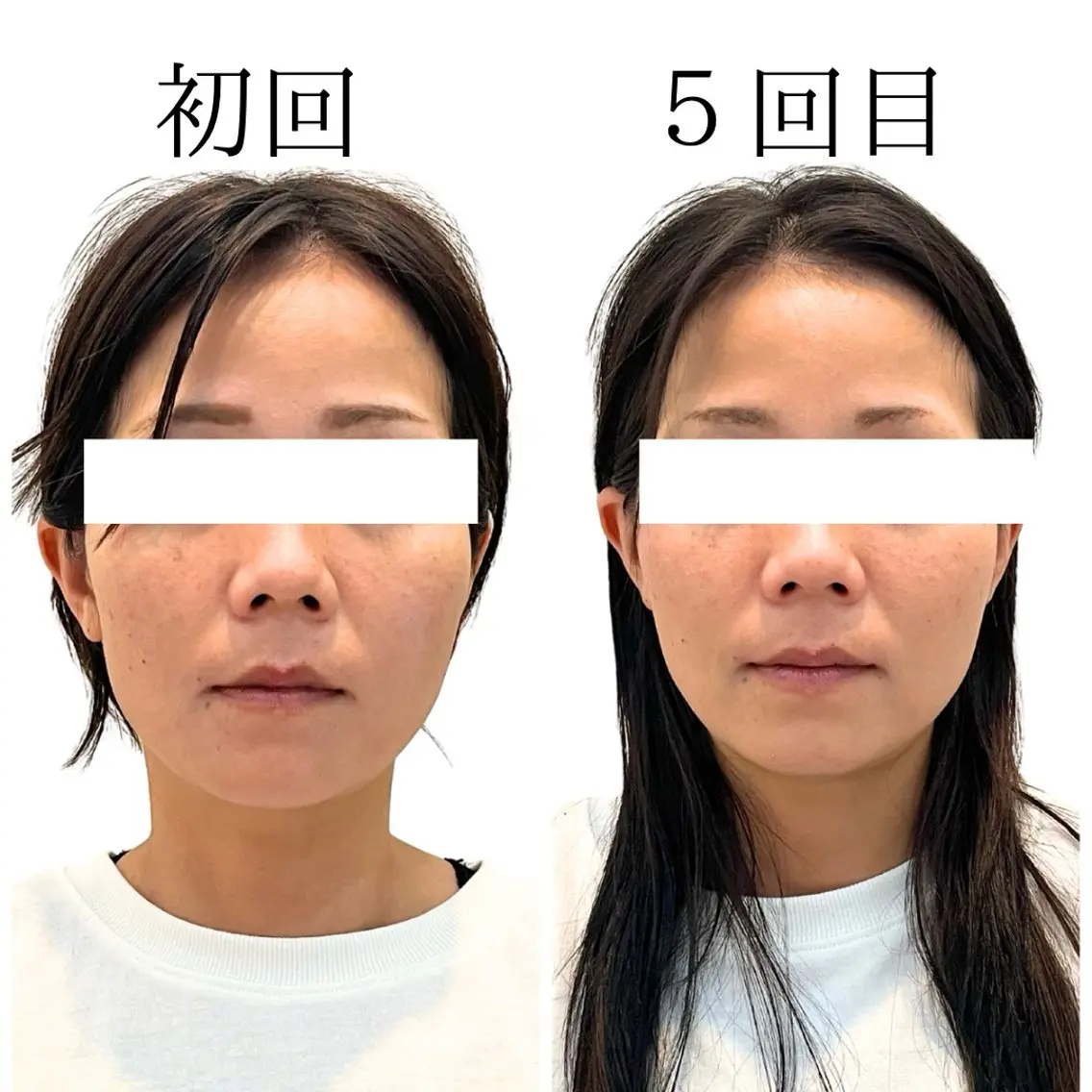 コアの木整骨院高津院 藤内尚志のエステ・リラクイメージ