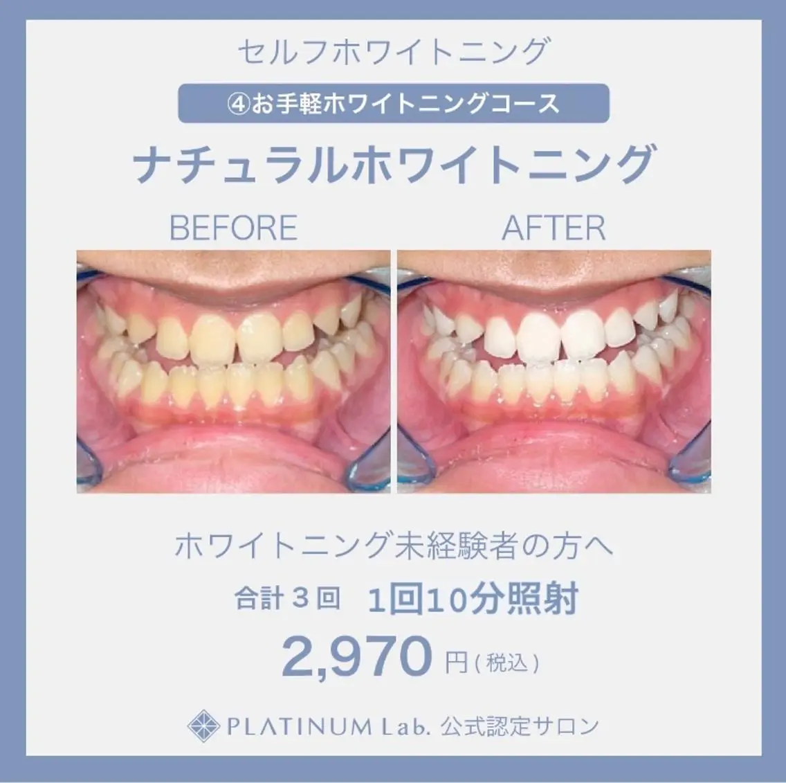 メンズ キッズ ネイル マツエク・マツパ アイブロウ 【歯科提携】柏ホワイ トニングスタイルのその他イメージ