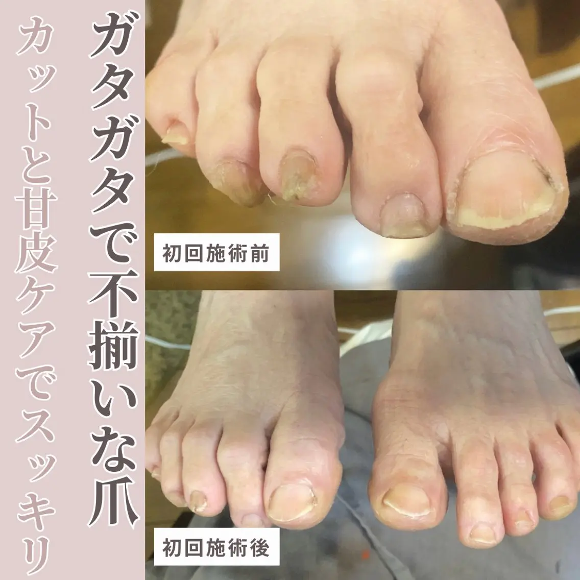 ネイル フットネイル フットネイル Studio Jivanのネイルデザイン