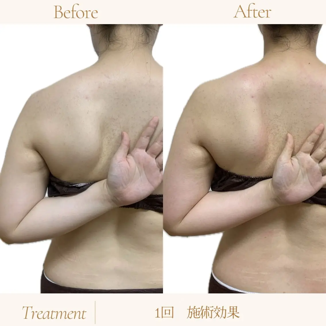部分施術でお試ししたい方向けの写真