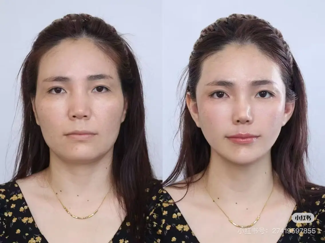 ショート 愛維美水光専門店 川崎彩鳳のエステ・リラクイメージ
