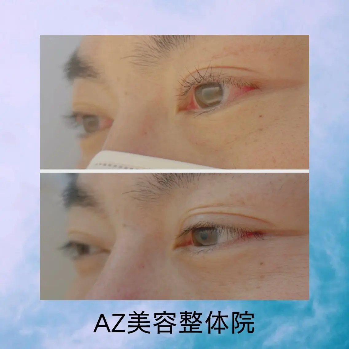 マツエク・マツパ フラットラッシュ まつげパーマ 一重×まつ毛パーマ マツパ AZ美・整体院　川畑 保代のマツエク・マツパデザイン