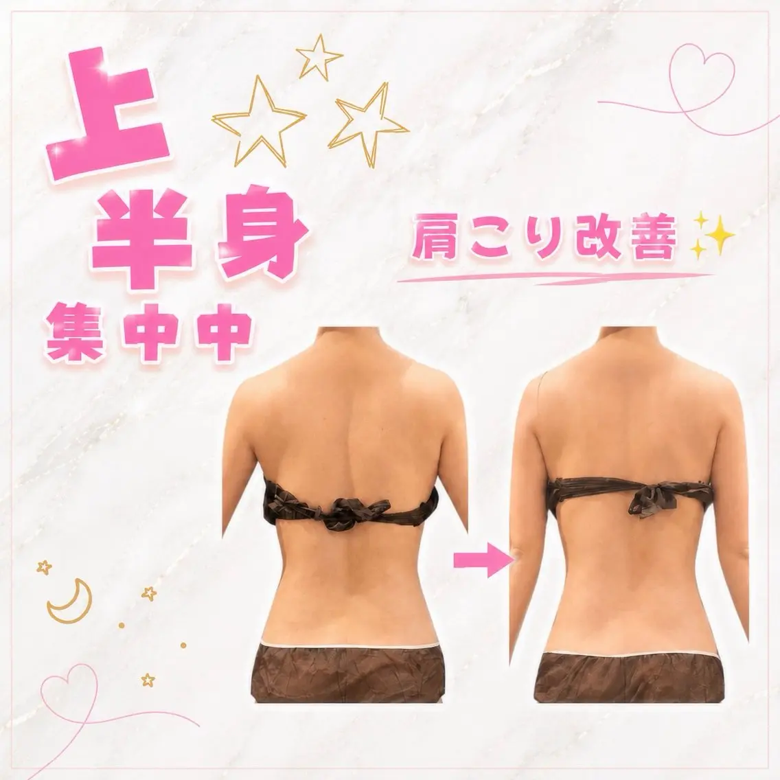 背中美人コース🫣 圧倒的リピート率97%❕業界No.1超音波で痩せない原因となるガチガチ脂肪や頑固なコリにアタック✨の写真