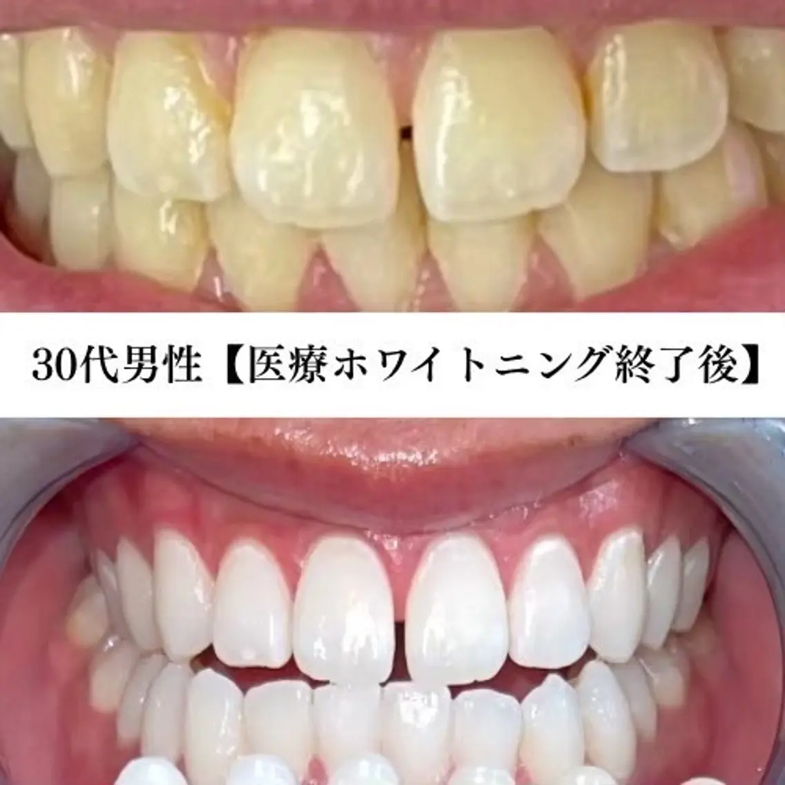 キッズ メンズ セルフホワイトニング WHITE福岡博多店のエステ・リラクイメージ