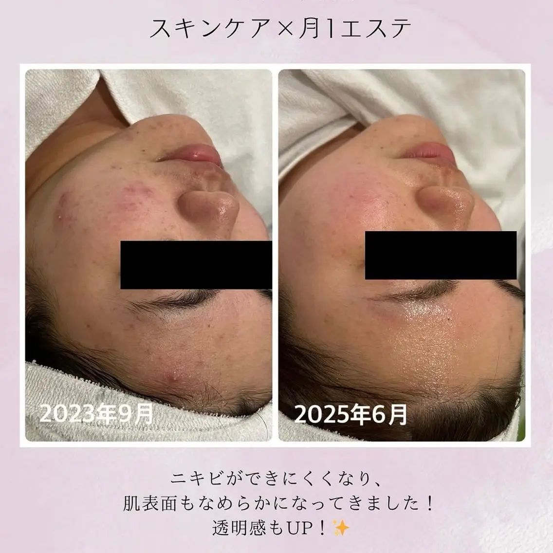 ナリス化粧品 Yumenaのエステ・リラクイメージ