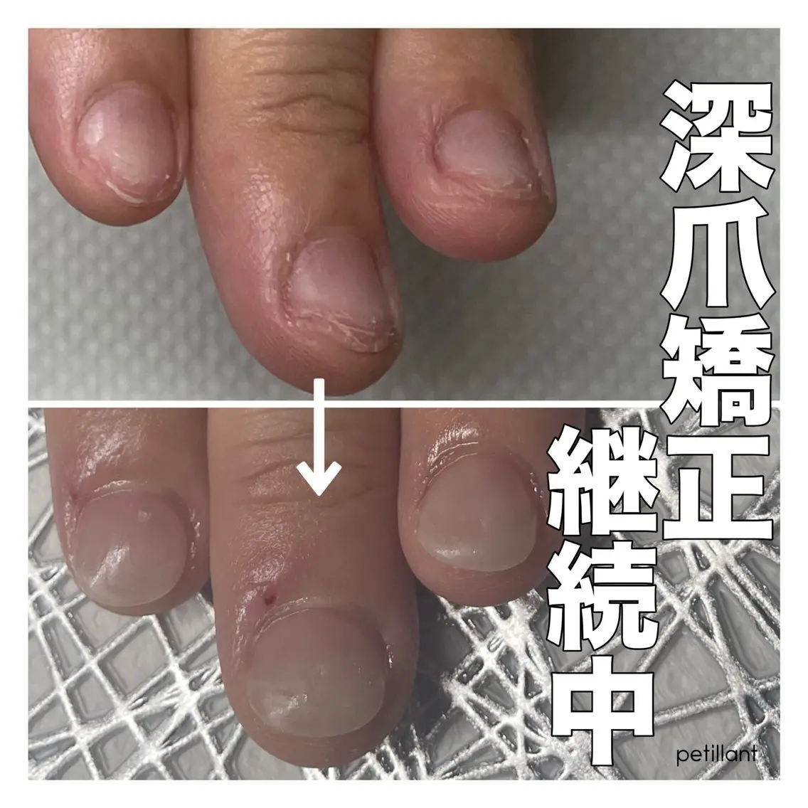 ネイル ジェルネイル ハンドネイル ハンドケア nail salon petillantのネイルデザイン